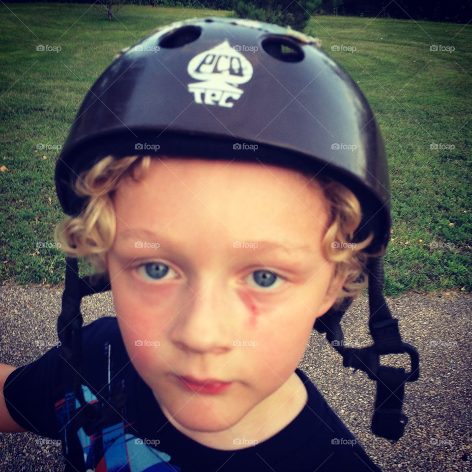 Boy in helmet with scratch . Boy in helmet with scratch on face