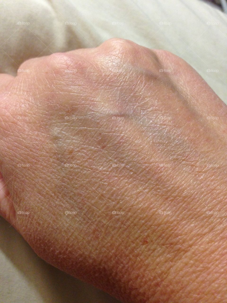 This is the top of a right hand of a 44 year old Caucasian woman.