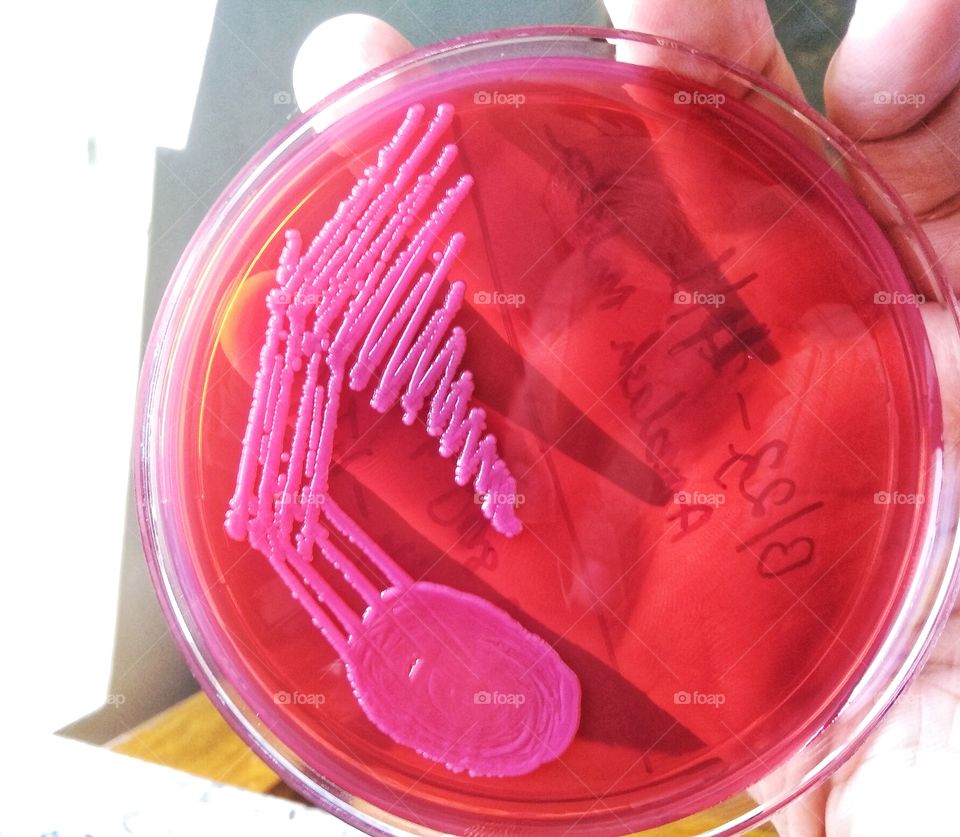 Bacteria culture plate