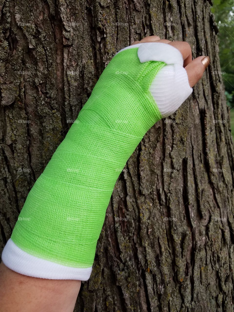 green cast