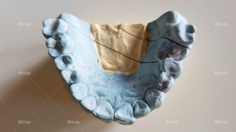 Dental impressions