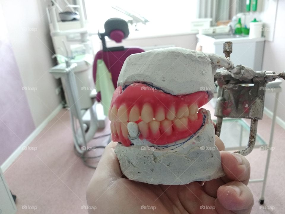 Dentures wax on dental model