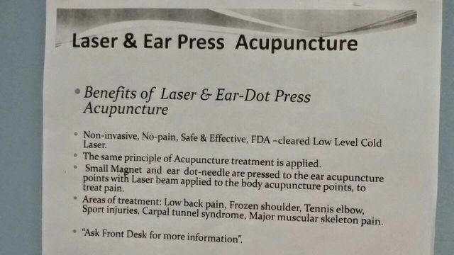 Accupuncture relief