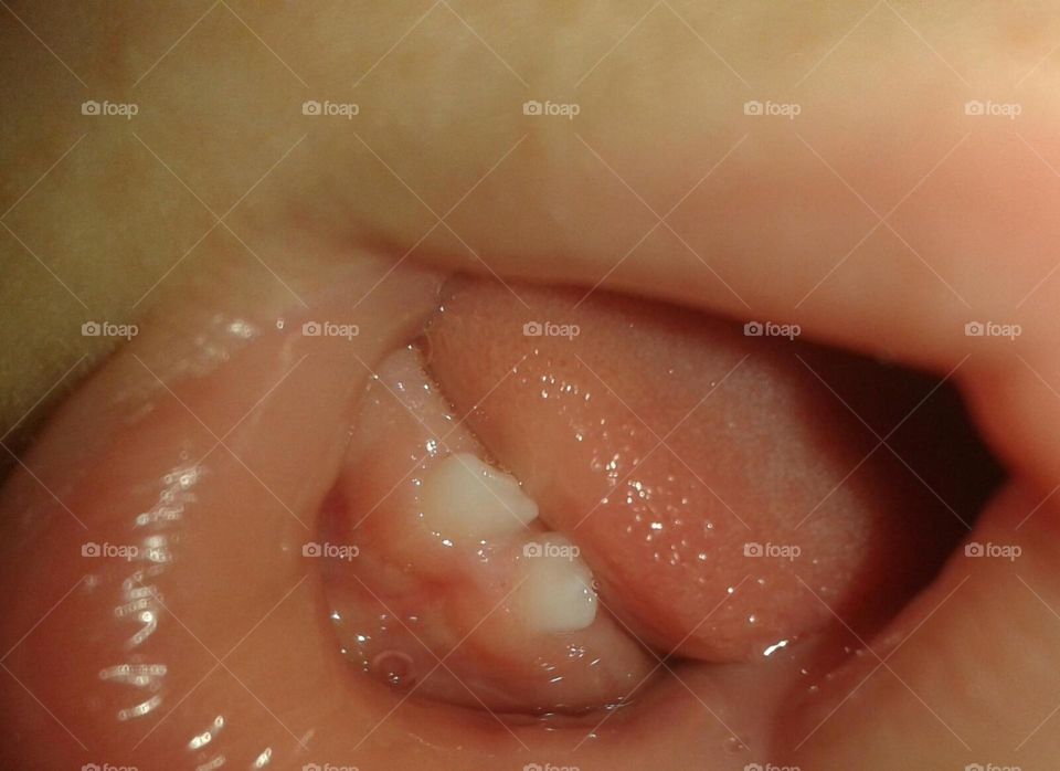 first tooth 