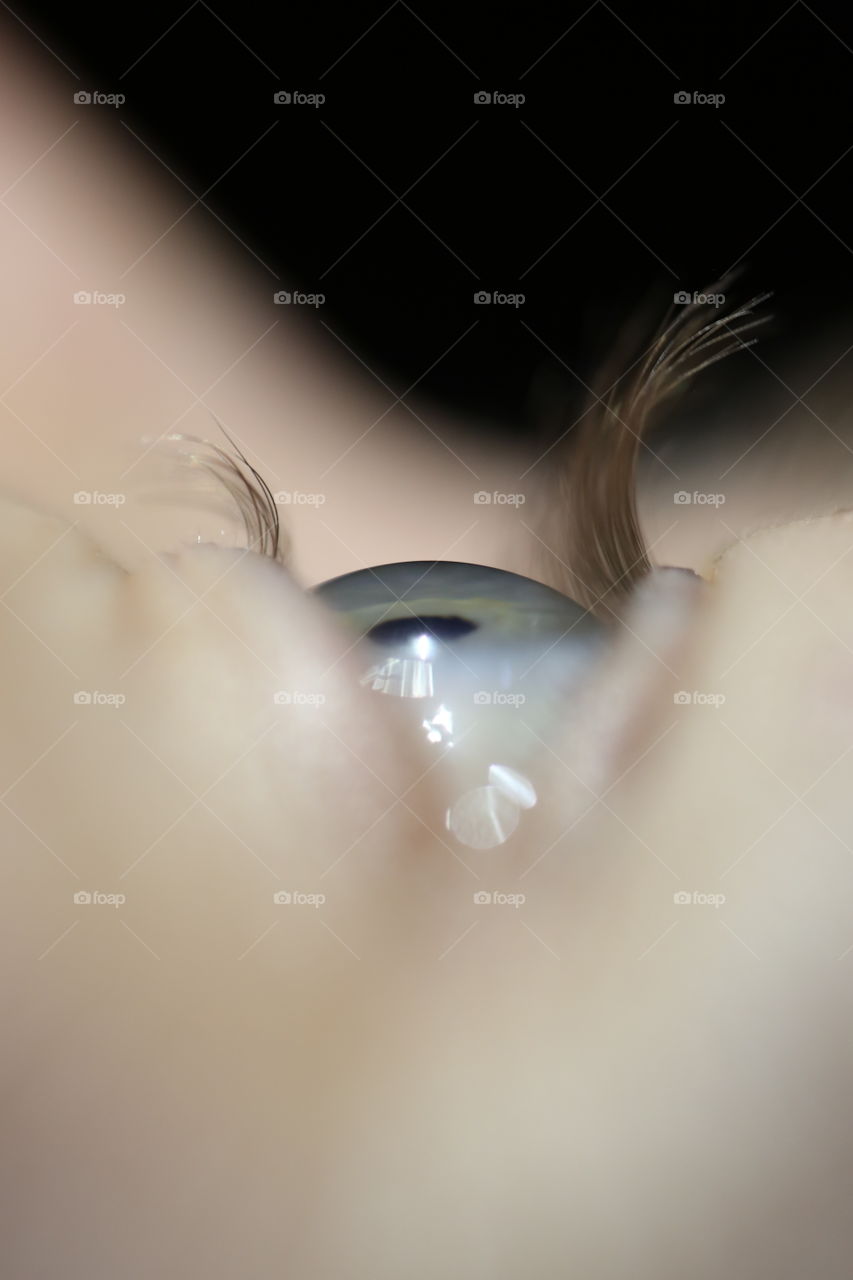 Eye profile 