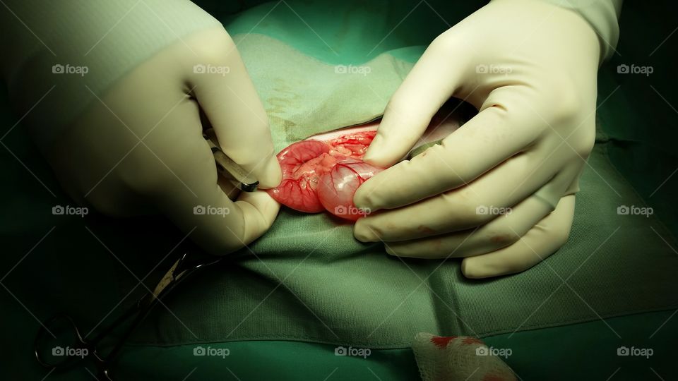 Close-up of surgery