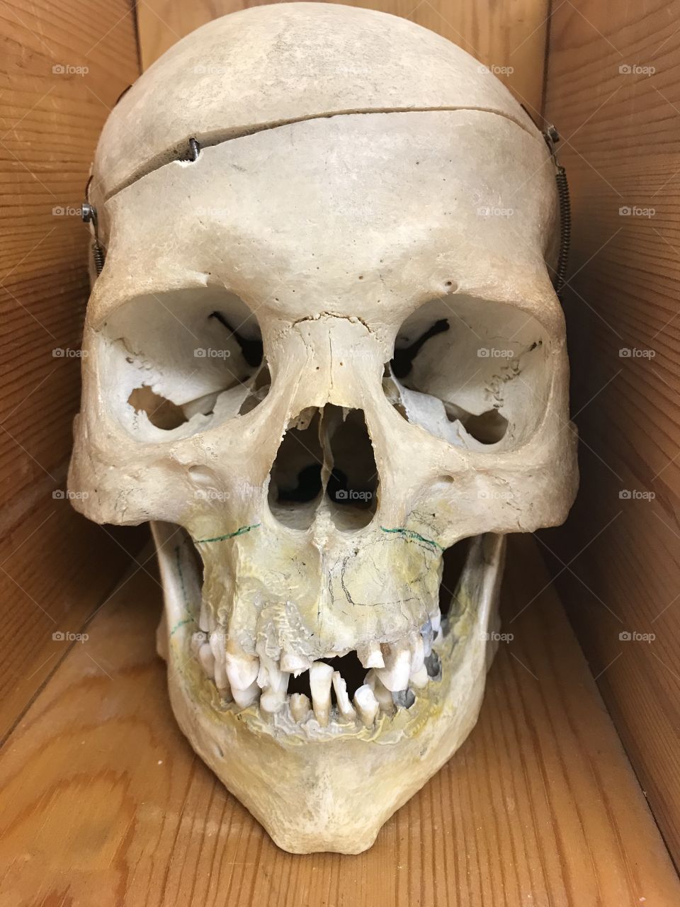 Human skull