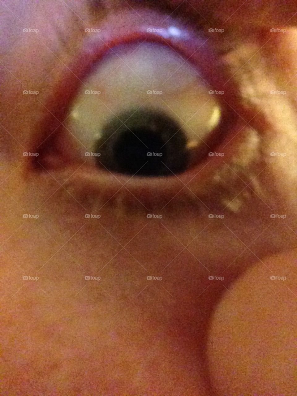 Eye eye eye 