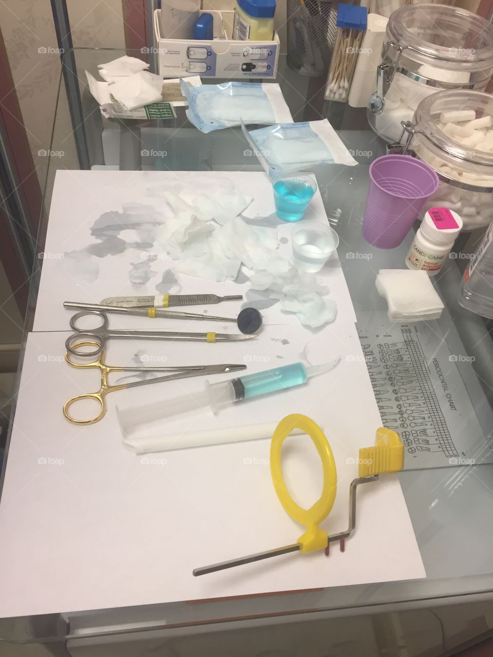 A dental set up for a restoration for teeth 