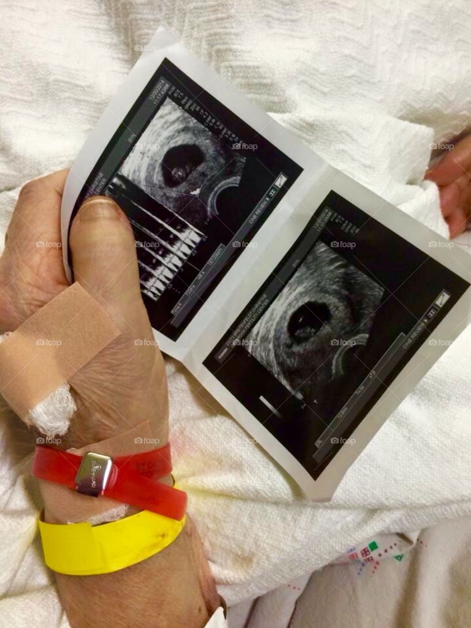 Great grandma with great grandson's ultrasound 