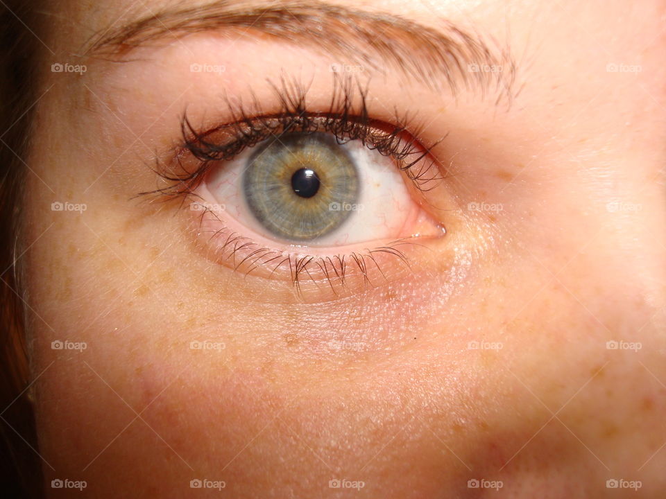 My (now 28 year old) daughter's eye when she was just 17