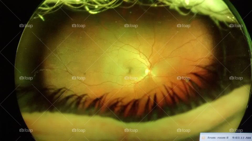 Inside of Eye