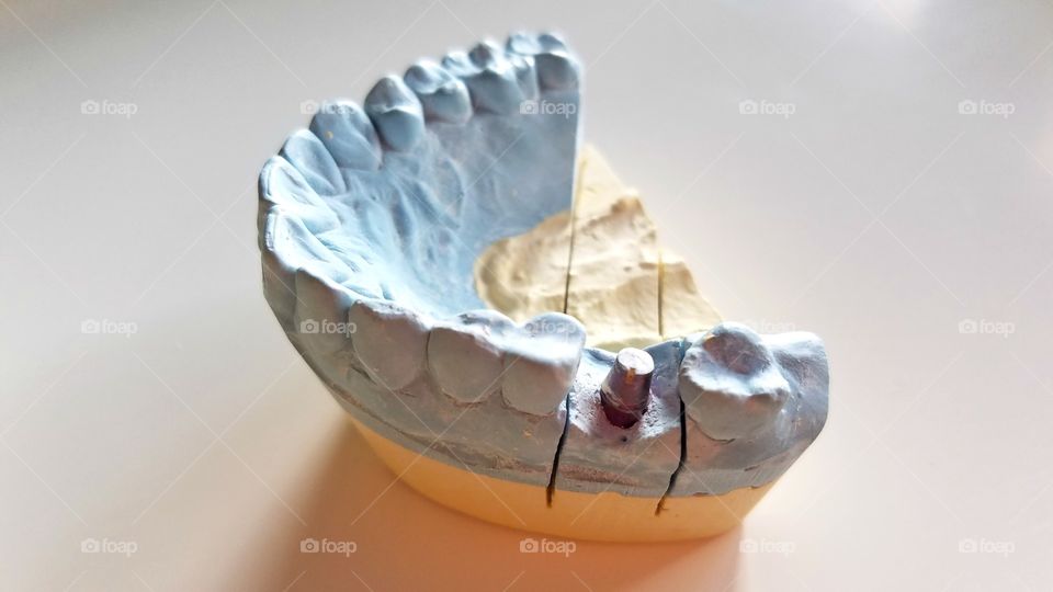 Blue dental impressions