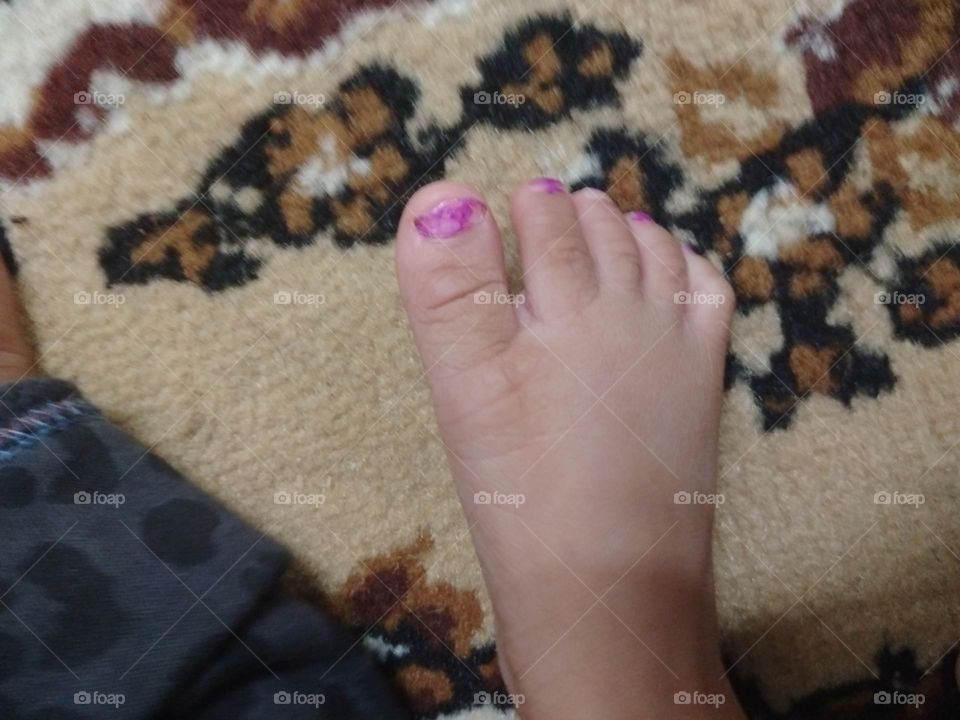 Baby foot