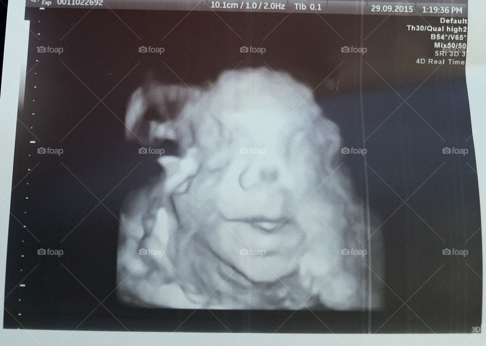 Ultrasound baby face