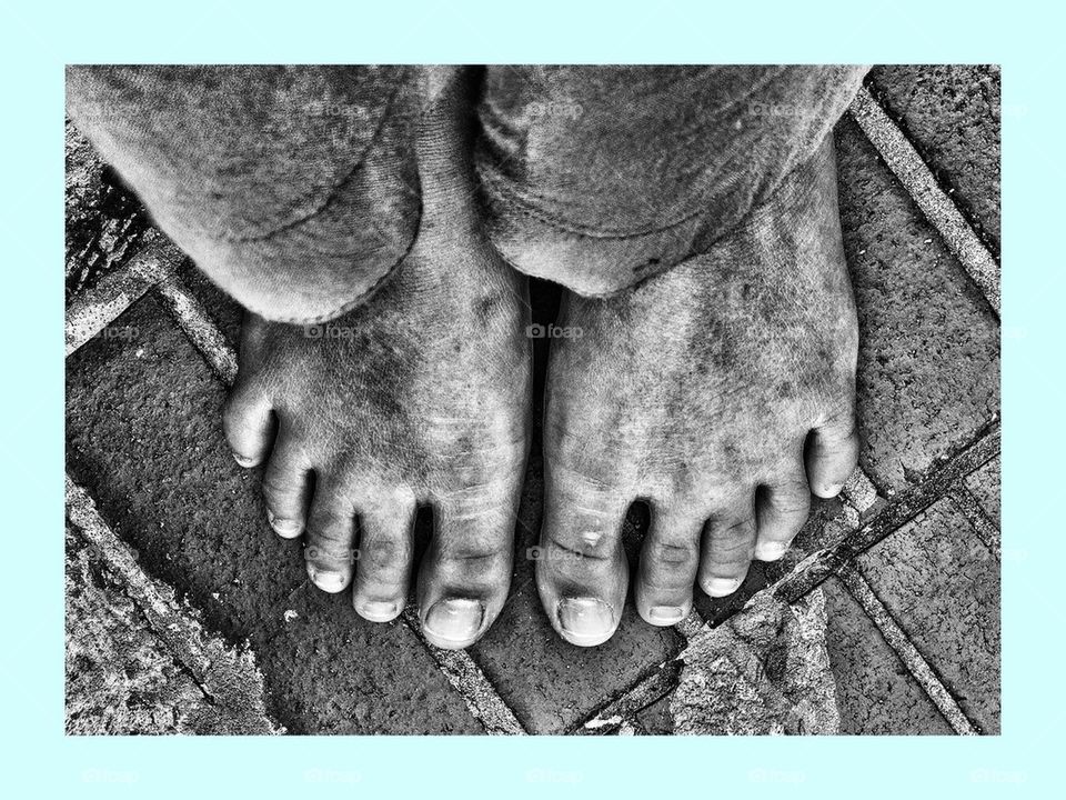 Raw feet 