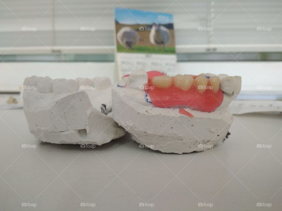 Dentures prototype