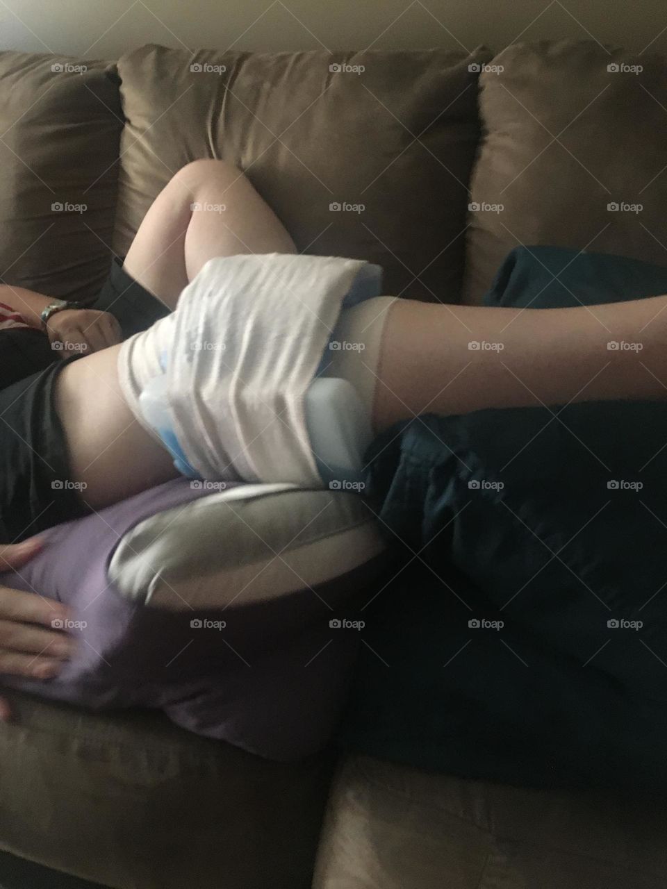 Elevated, ice packed, wrapped middle aged womens leg, who hurt her knee 