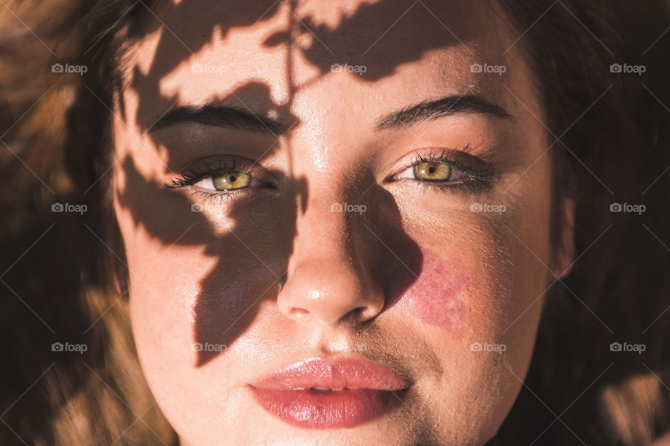 A woman hazel eyes under plants on a sunny summer day with a birthmark 